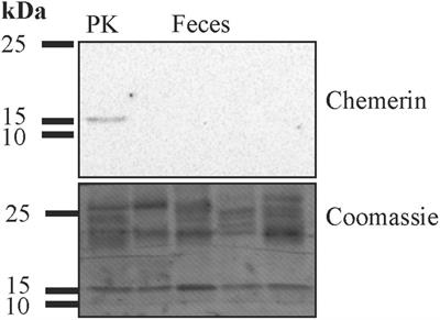 Urinary chemerin as a potential biomarker for inflammatory bowel disease